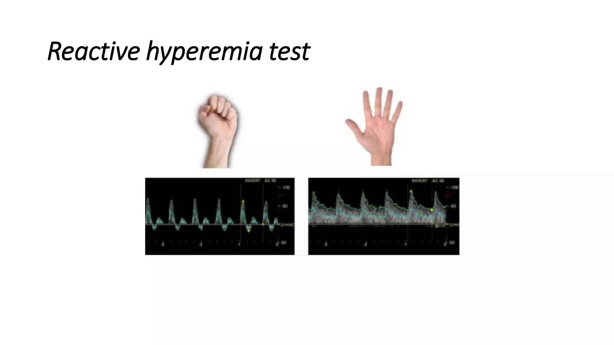 Reactive hyperemia test