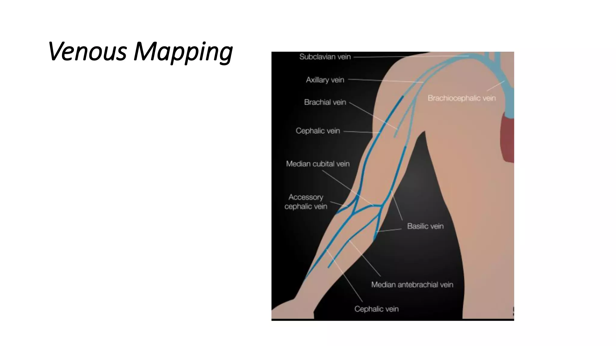 Venous Mapping