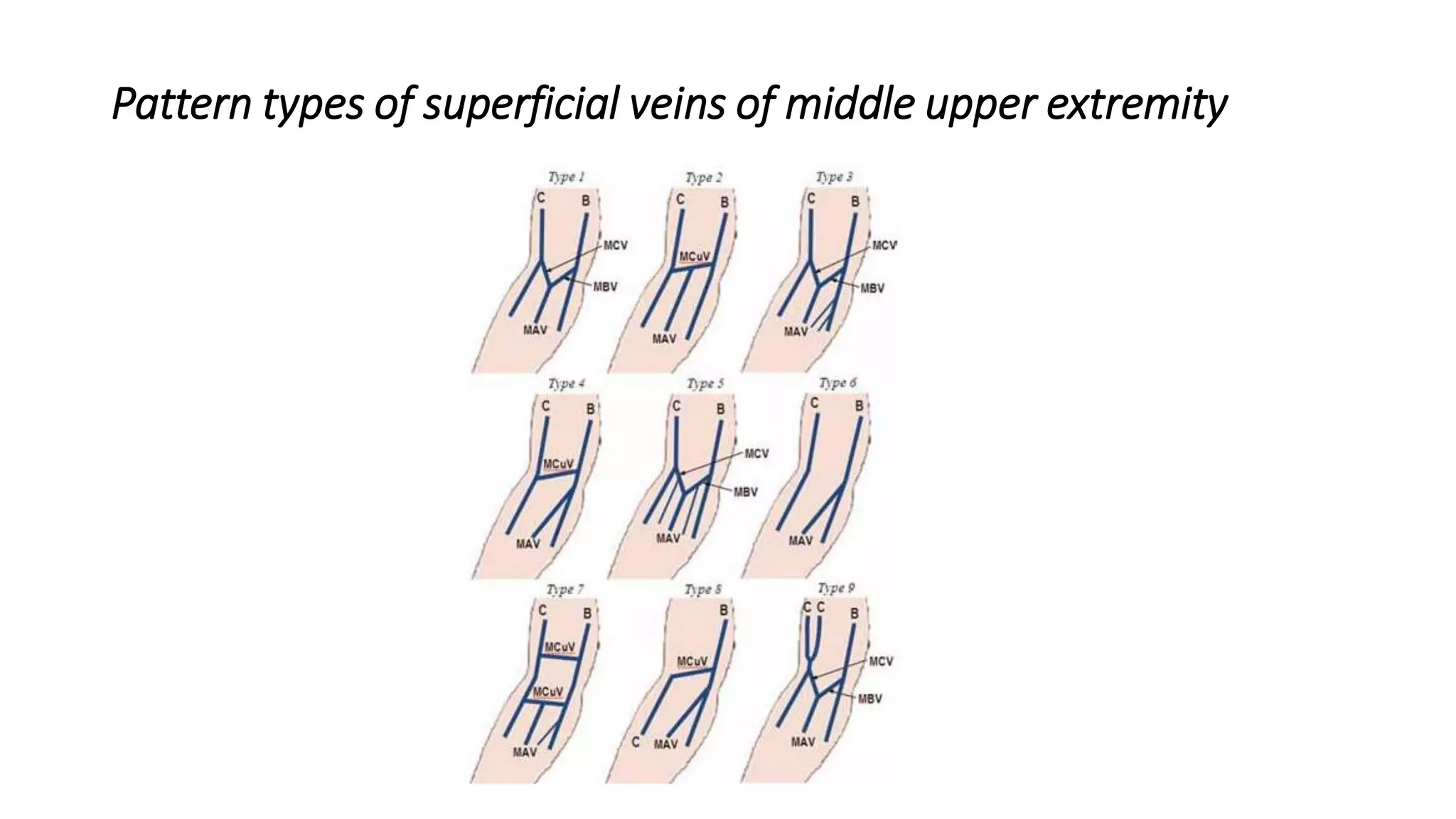 Pattern types of superficial veins of middle upper extremity