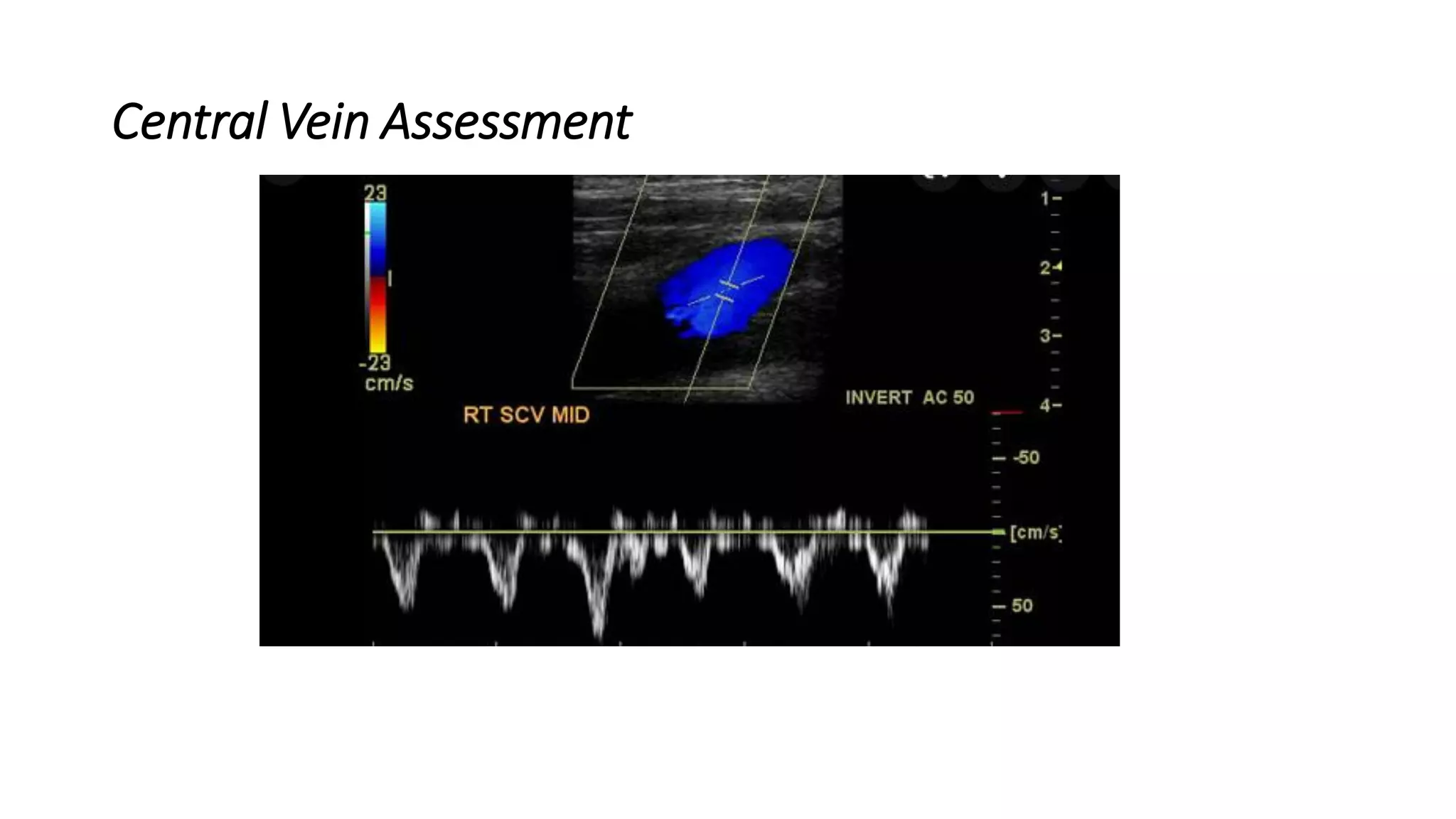 Central Vein Assessment