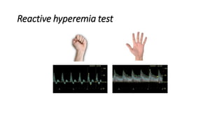 Reactive hyperemia test