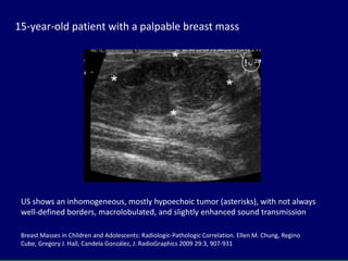Ultrasound of pediatric and adolescent breast