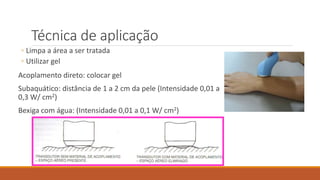 Técnica de aplicação 
◦ Limpa a área a ser tratada 
◦ Utilizar gel 
Acoplamento direto: colocar gel 
Subaquático: distância de 1 a 2 cm da pele (Intensidade 0,01 a 
0,3 W/ cm2) 
Bexiga com água: (Intensidade 0,01 a 0,1 W/ cm2) 
 