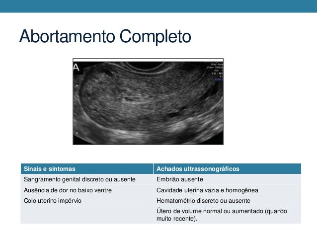 síntomas de diabetes en el saco gestacional de forma irregular síntomas de diabetes en el saco gestacional de forma irregular