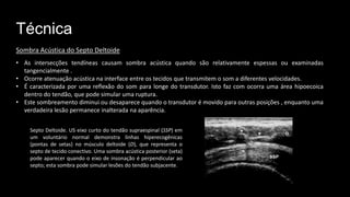 Técnica
• As intersecções tendíneas causam sombra acústica quando são relativamente espessas ou examinadas
tangencialmente .
• Ocorre atenuação acústica na interface entre os tecidos que transmitem o som a diferentes velocidades.
• É caracterizada por uma reflexão do som para longe do transdutor. Isto faz com ocorra uma área hipoecoica
dentro do tendão, que pode simular uma ruptura.
• Este sombreamento diminui ou desaparece quando o transdutor é movido para outras posições , enquanto uma
verdadeira lesão permanece inalterada na aparência.
Sombra Acústica do Septo Deltoide
Septo Deltoide. US eixo curto do tendão supraespinal (SSP) em
um voluntário normal demonstra linhas hiperecogênicas
(pontas de setas) no músculo deltoide (D), que representa o
septo de tecido conectivo. Uma sombra acústica posterior (seta)
pode aparecer quando o eixo de insonação é perpendicular ao
septo; esta sombra pode simular lesões do tendão subjacente.
 