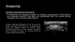 Anatomia
Interface Supraespinal-Infraespinal
• O afilamento do manguito rotador na interface supraespinal- infraespinal é
um achando normal e não deve ser confundido com um rotura parcial.
Comparar com o ombro contralateral
Interface supraespinal-infraespinal. US do eixo curto do
tendão supraespinal (SSP) demonstra um adelgaçamento
normal do manguito rotador na interface (setas)
supraespinal-infraespinal. Há uma diferença significativa
entre o diâmetro na interface e o diâmetro normal do
manguito rotador (ponta de seta).
 