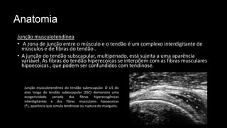 Anatomia
Junção musculotendínea
• A zona de junção entre o músculo e o tendão é um complexo interdigitante de
músculos e de fibras do tendão .
• A junção do tendão subscapular, multipenado, está sujeita a uma aparência
variável. As fibras do tendão hiperecoicas se interpõem com as fibras musculares
hipoecoicas , que podem ser confundidos com tendinose.
Junção musculotendínea do tendão subescapular. O US do
eixo longo do tendão subescapular (SSC) demonstra uma
ecogenicidade variada das fibras hiperecogênicas
interdigitantes e das fibras musculares hipoecoicas
(*), aparência que simula tendinose ou ruptura do manguito.
 