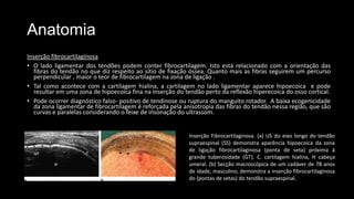 Anatomia
Inserção fibrocartilaginosa
• O lado ligamentar dos tendões podem conter fibrocartilagem. Isto está relacionado com a orientação das
fibras do tendão no que diz respeito ao sítio de fixação óssea. Quanto mais as fibras seguirem um percurso
perpendicular , maior o teor de fibrocartilagem na zona de ligação .
• Tal como acontece com a cartilagem hialina, a cartilagem no lado ligamentar aparece hipoecoica e pode
resultar em uma zona de hipoecoica fina na inserção do tendão perto da reflexão hiperecoica do osso cortical.
• Pode ocorrer diagnóstico falso- positivo de tendinose ou ruptura do manguito rotador. A baixa ecogenicidade
da zona ligamentar de fibrocartilagem é reforçada pela anisotropia das fibras do tendão nessa região, que são
curvas e paralelas considerando o feixe de insonação do ultrassom.
Inserção Fibrocartilaginosa. (a) US do eixo longo do tendão
supraespinal (SS) demonstra aparência hipoecoica da zona
de ligação fibrocartilaginosa (ponta de seta) próxima à
grande tuberosidade (GT). C. cartilagem hialina, H cabeça
umeral. (b) Secção macroscópica de um cadáver de 78 anos
de idade, masculino, demonstra a inserção fibrocartilaginosa
do (pontas de setas) do tendão supraespinal.
 
