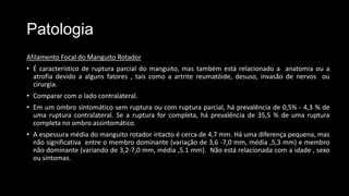 Patologia
Afilamento Focal do Manguito Rotador
• É característico de ruptura parcial do manguito, mas também está relacionado a anatomia ou a
atrofia devido a alguns fatores , tais como a artrite reumatóide, desuso, invasão de nervos ou
cirurgia.
• Comparar com o lado contralateral.
• Em um ombro sintomático sem ruptura ou com ruptura parcial, há prevalência de 0,5% - 4,3 % de
uma ruptura contralateral. Se a ruptura for completa, há prevalência de 35,5 % de uma ruptura
completa no ombro assintomático.
• A espessura média do manguito rotador intacto é cerca de 4,7 mm. Há uma diferença pequena, mas
não significativa entre o membro dominante (variação de 3,6 -7,0 mm, média ,5,3 mm) e membro
não dominante (variando de 3,2-7,0 mm, média ,5.1 mm). Não está relacionada com a idade , sexo
ou sintomas.
 
