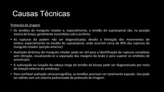 Causas Técnicas
Protocolo de imagem
• Os tendões do manguito rotador e, especialmente, o tendão do supraespinal são, na posição
neutra do braço, geralmente escondidos sob o acrômio.
• As rupturas do podem não ser diagnosticadas devido a limitação dos movimentos do
ombro, especialmente no tendão do supraespinal, onde ocorrem cerca de 90% das rupturas do
manguito rotador (porção anterior).
• Avaliação dinâmica do manguito rotador pode ser útil para a identificação de rupturas completas
sem retração, visualizando-se a separação das margens da lesão e para superar os artefatos de
anisotropia.
• A subluxação ou luxação da cabeça longa do tendão do bíceps pode ser diagnosticada por meio
de rotação externa do antebraço.
• Para confiável avaliação ultrassonográfica, os tendões precisam ser totalmente exposto. Isto pode
ser obtido com um sistema padronizado de protocolo de imagem .
 