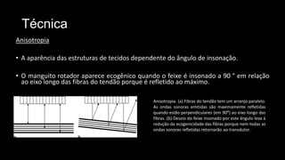 Técnica
Anisotropia
• A aparência das estruturas de tecidos dependente do ângulo de insonação.
• O manguito rotador aparece ecogênico quando o feixe é insonado a 90 ° em relação
ao eixo longo das fibras do tendão porque é refletido ao máximo.
Anisotropia. (a) Fibras do tendão tem um arranjo paralelo.
As ondas sonoras emitidas são maximamente refletidas
quando estão perpendiculares (em 90⁰) ao eixo longo das
fibras. (b) Desvio do feixe insonado por este ângulo leva à
redução da ecogenicidade das fibras porque nem todas as
ondas sonoras refletidas retornarão ao transdutor.
 
