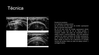 Técnica
Posição do transdutor.
D. m. deltoide, H cabeça umeral.
(a) US normal do eixo longo do tendão supraespinal
(SSP). GT grande tuberosidade.
(b) US do eixo curto do tendão supraespinal obtido
lateralmente (na linha 4b em a). Nessa posição, o
manguito rotador não pode ser visualizado entre a
cabeça umeral o músculo deltoide, com uma aparência
sugestiva de ruptura completa do tendão supraespinal.
(c) US normal do eixo curto do tendão supraespinal
(SSP), obtido na linha 4c em a demonstra as camadas
normais de tecidos moles ao redor da cabeça umeral. c
cartilagem hialina.
 