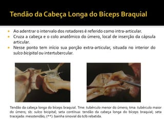  Ao adentrar o intervalo dos rotadores é referido como intra-articular.
 Cruza a cabeça e o colo anatômico do úmero, local de inserção da cápsula
articular.
 Nesse ponto tem início sua porção extra-articular, situada no interior do
sulco bicipital ou intertubercular.
Tendão da cabeça longa do bíceps braquial. Tme: tubérculo menor do úmero; tma: tubérculo maior
do úmero; sb: sulco bicipital; seta contínua: tendão da cabeça longa do bíceps braquial; seta
tracejada: mesotendão; (**): bainha sinovial do tclb rebatida.
 