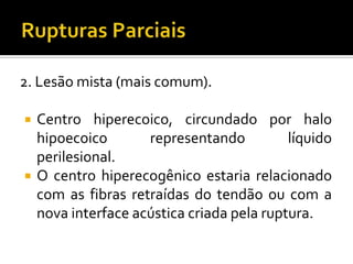 2. Lesão mista (mais comum).
 Centro hiperecoico, circundado por halo
hipoecoico representando líquido
perilesional.
 O centro hiperecogênico estaria relacionado
com as fibras retraídas do tendão ou com a
nova interface acústica criada pela ruptura.
 