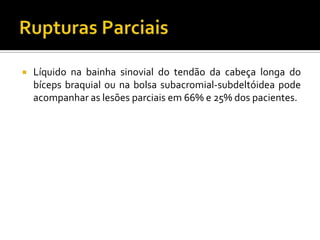  Líquido na bainha sinovial do tendão da cabeça longa do
bíceps braquial ou na bolsa subacromial-subdeltóidea pode
acompanhar as lesões parciais em 66% e 25% dos pacientes.
 