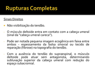 Sinais Direitos
 Não visibilização do tendão.
- O músculo deltoide entra em contato com a cabeça umeral
(sinal da “cabeça umeral careca”).
- Pode ser notada pequena imagem ecogênica em faixa entre
ambos - espessamento da bolsa sinovial ou tecido de
reparação (fibrose) na topografia do tendão.
- Com a ausência do tendão do supraespinal, o músculo
deltoide pode atuar sem antagonista, determinando
subluxação superior da cabeça umeral com redução do
espaço subacromial.
 