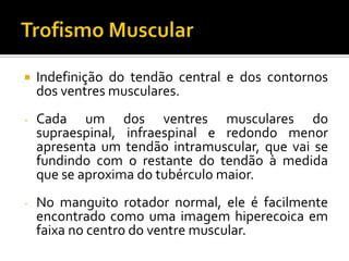  Indefinição do tendão central e dos contornos
dos ventres musculares.
- Cada um dos ventres musculares do
supraespinal, infraespinal e redondo menor
apresenta um tendão intramuscular, que vai se
fundindo com o restante do tendão à medida
que se aproxima do tubérculo maior.
- No manguito rotador normal, ele é facilmente
encontrado como uma imagem hiperecoica em
faixa no centro do ventre muscular.
 