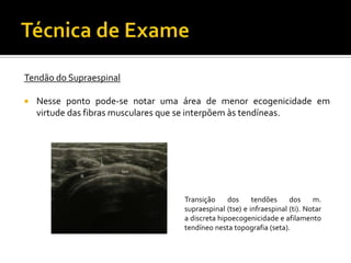 Tendão do Supraespinal
 Nesse ponto pode-se notar uma área de menor ecogenicidade em
virtude das fibras musculares que se interpõem às tendíneas.
Transição dos tendões dos m.
supraespinal (tse) e infraespinal (ti). Notar
a discreta hipoecogenicidade e afilamento
tendíneo nesta topografia (seta).
 