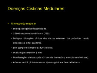 Doenças Císticas Medulares
• Rim esponja-medular
- Etiologia congênita desconhecida.
- 1:5000 nascimentos e bilateral (75%).
- Múltiplas dilatações císticas dos ductos coletores das pirâmides renais,
associadas a cistos papilares.
- Sem comprometimento da função renal.
- Os cistos geralmente < 3 mm.
- Manifestações clínicas: após a 3ª década (hematúria, infecção e nefrolitíase).
- Achados ao US: pirâmides renais hiperecogênicas e bem delimitadas.
 