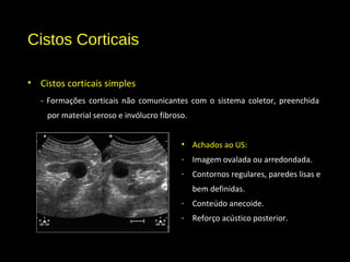 Cistos Corticais
• Cistos corticais simples
- Formações corticais não comunicantes com o sistema coletor, preenchida
por material seroso e invólucro fibroso.
• Achados ao US:
- Imagem ovalada ou arredondada.
- Contornos regulares, paredes lisas e
bem definidas.
- Conteúdo anecoide.
- Reforço acústico posterior.
 