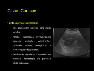 Cistos Corticais
• Cistos corticais complexos
- Não preenchem critérios para cistos
simples.
- Paredes espessadas, irregularidades
parietais, septações, calcificações,
conteúdo espesso (ecogênico) e
formações sólidas parietais.
- Geralmente associados à episódios de
infecção, hemorragia ou processo
sólido expansivo.
 