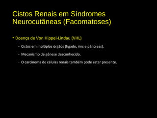 Cistos Renais em Síndromes
Neurocutâneas (Facomatoses)
• Doença de Von Hippel-Lindau (VHL)
- Cistos em múltiplos órgãos (fígado, rins e pâncreas).
- Mecanismo de gênese desconhecido.
- O carcinoma de células renais também pode estar presente.
 