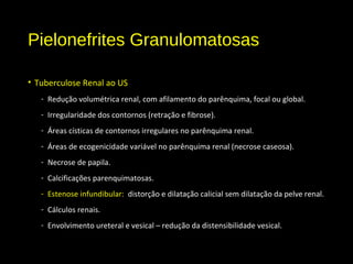 Pielonefrites Granulomatosas
• Tuberculose Renal ao US
- Redução volumétrica renal, com afilamento do parênquima, focal ou global.
- Irregularidade dos contornos (retração e fibrose).
- Áreas císticas de contornos irregulares no parênquima renal.
- Áreas de ecogenicidade variável no parênquima renal (necrose caseosa).
- Necrose de papila.
- Calcificações parenquimatosas.
- Estenose infundibular: distorção e dilatação calicial sem dilatação da pelve renal.
- Cálculos renais.
- Envolvimento ureteral e vesical – redução da distensibilidade vesical.
 