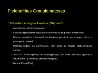 Pielonefrites Granulomatosas
• Pielonefrite Xantogranulomatosa (PNX) ao US
- Aumento das dimensões renais.
- Calculose (geralmente cálculos coraliformes ou de grandes dimensões).
- Fibrose peripiélica e hidronefrose (material purulento no sistema coletor e
pelve pode ocorrer).
- Heterogeneidade do parênquima, com perda da relação corticomedular
normal
- “Massas” hipoecogênicas ou isoecogênicas, com fluxo periférico (processo
inflamatório) e sem fluxo central ao Doppler.
- Focal x Difusa (85%).
 