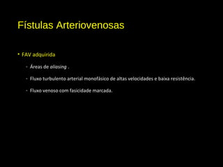Fístulas Arteriovenosas
• FAV adquirida
- Áreas de aliasing .
- Fluxo turbulento arterial monofásico de altas velocidades e baixa resistência.
- Fluxo venoso com fasicidade marcada.
 
