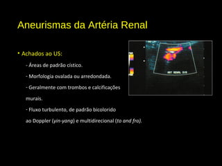 Aneurismas da Artéria Renal
• Achados ao US:
- Áreas de padrão cístico.
- Morfologia ovalada ou arredondada.
- Geralmente com trombos e calcificações
murais.
- Fluxo turbulento, de padrão bicolorido
ao Doppler (yin-yang) e multidirecional (to and fro).
 