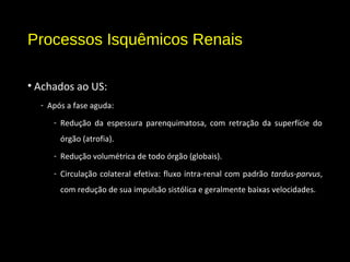 Processos Isquêmicos Renais
• Achados ao US:
- Após a fase aguda:
- Redução da espessura parenquimatosa, com retração da superfície do
órgão (atrofia).
- Redução volumétrica de todo órgão (globais).
- Circulação colateral efetiva: fluxo intra-renal com padrão tardus-parvus,
com redução de sua impulsão sistólica e geralmente baixas velocidades.
 