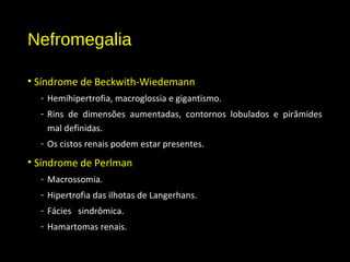 Nefromegalia
• Síndrome de Beckwith-Wiedemann
- Hemihipertrofia, macroglossia e gigantismo.
- Rins de dimensões aumentadas, contornos lobulados e pirâmides
mal definidas.
- Os cistos renais podem estar presentes.
• Síndrome de Perlman
- Macrossomia.
- Hipertrofia das ilhotas de Langerhans.
- Fácies sindrômica.
- Hamartomas renais.
NefromegaliaNefromegalia
 