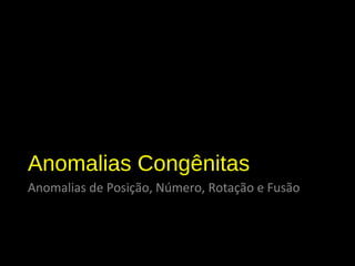Anomalias Congênitas
Anomalias de Posição, Número, Rotação e Fusão
Nefromegalia
 
