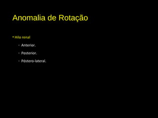 Anomalia de Rotação
• Hilo renal
- Anterior.
- Posterior.
- Póstero-lateral.
 