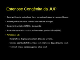 Estenose Congênita da JUP
• Desenvolvimento anômalo de fibras musculares lisas do ureter com fibrose.
• Aalteração funcional que culmina com estase e dilatação.
• Geralmente unilateral (70%) e à esquerda.
• Pode estar associado à outras malformações genitourinárias (27%).
• Achados ao US:
- Hidronefrose de grau variável sem dilatação ureteral.
- Crônica - acentuada hidronefrose, com afilamento do parênquima renal.
- Terminal - massa cística ocupando a loja renal.
 