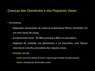 Doenças dos Glomérulos e dos Pequenos Vasos
• Amiloidose
- Deposição extracelular de material proteináceo fibrilar (amilóide) em
um mais locais do corpo.
- Envolvimento renal - 35-40% prímária e 80% na secundária.
- Depósito de amilóide nos glomérulos e no interstício, com fibrose
intersticial e atrofia secundária dos túbulos renais,
- Achados ao US:
- Inicial: aumento bilateral renal e hiperecogenicidade do parenquima.
- Tardia: redução das dimensões renais.
 