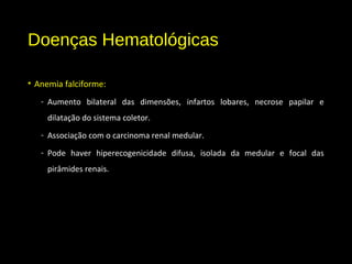 Doenças Hematológicas
• Anemia falciforme:
- Aumento bilateral das dimensões, infartos lobares, necrose papilar e
dilatação do sistema coletor.
- Associação com o carcinoma renal medular.
- Pode haver hiperecogenicidade difusa, isolada da medular e focal das
pirâmides renais.
 