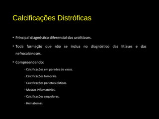 Calcificações Distróficas
• Principal diagnóstico diferencial das urolitíases.
• Toda formação que não se inclua no diagnóstico das litíases e das
nefrocalcinoses.
• Compreendendo:
- Calcificações em paredes de vasos.
- Calcificações tumorais.
- Calcificações parietais císticas.
- Massas inflamatórias.
- Calcificações sequelares.
- Hematomas.
 