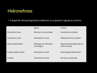 Hidronefrose
• É papel do ultrassonografista evidenciar se o quadro é agudo ou crônico.
Aguda Crônica
Dimensões renais Normais ou aumentadas Geralmente reduzidas
Parênquima renal Geralmente normal Afilamento focal ou global
Sistema pielocalicial Dilatação sem alteração
morfológica
Baqueteamento/distorção do
sistema calicial
Ecogenicidade cortical Geralmente normal Hiperecogenicidade difusa
Urotélio Geralmente normal Normal ou espessado
 