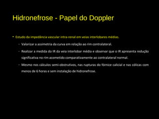 Hidronefrose - Papel do Doppler
• Estudo da impedância vascular intra-renal em veias interlobares médias.
- Valorizar a assimetria da curva em relação ao rim contralateral.
- Realizar a medida do IR da veia interlobar média e observar que o IR apresenta redução
significativa no rim acometido comparativamente ao contralateral normal.
- Mesmo nos cálculos semi-obstrutivos, nas rupturas do fórnice calicial e nas cólicas com
menos de 6 horas e sem instalação de hidronefrose.
 