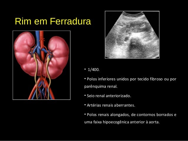 Ultrassom do rim