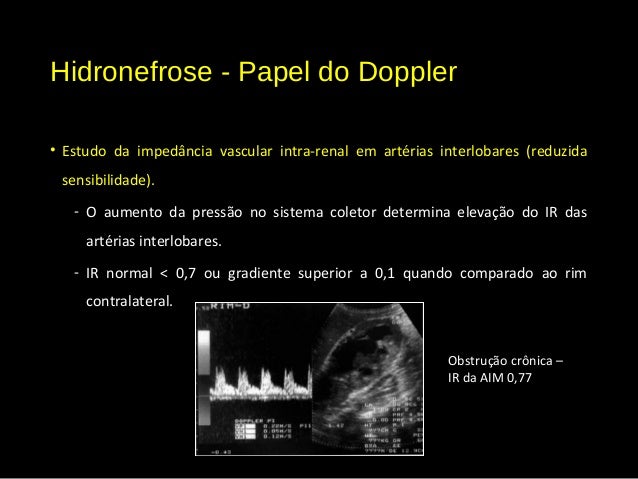 Ultrassom do rim