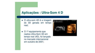 Ultrassom transdutores.pptx