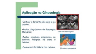 Ultrassom transdutores.pptx