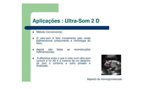 Ultrassom transdutores.pptx