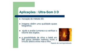 Ultrassom transdutores.pptx