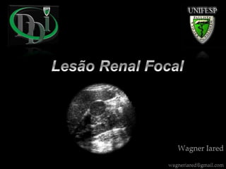 Ultrassonografia da lesão renal focal
