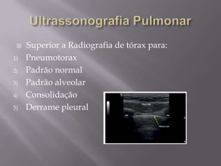    Superior a Radiografia de tórax para:
1)   Pneumotorax
2)   Padrão normal
3)   Padrão alveolar
4)   Consolidação
5)   Derrame pleural
 