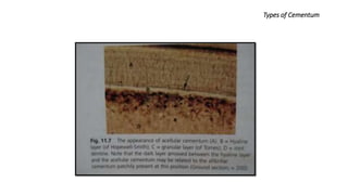Types of Cementum
 