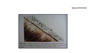 Types of Cementum
 